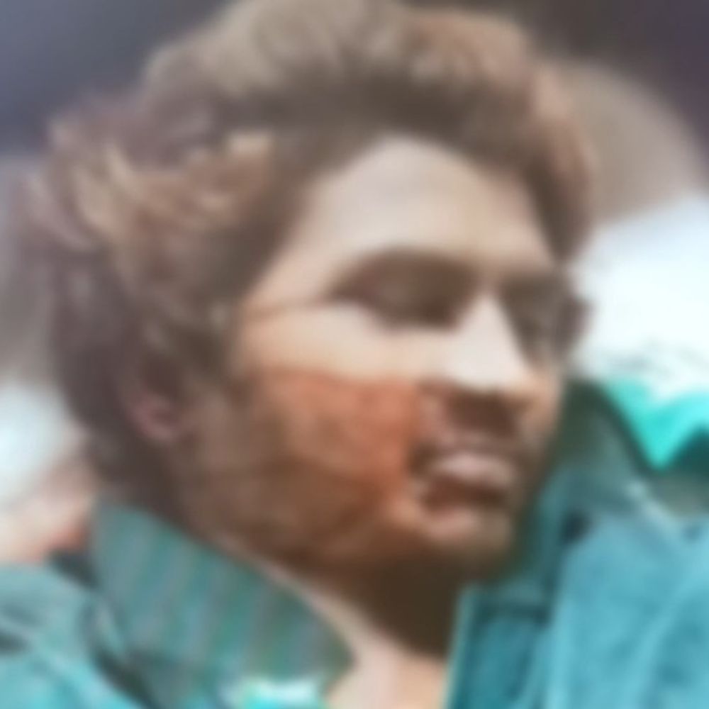 कोरबा में अज्ञात वाहन ने युवक को मारी टक्कर, मौत:सिर और सीने पर आई गंभीर चोटें, ड्राइवर की तलाश में जुटी पुलिस