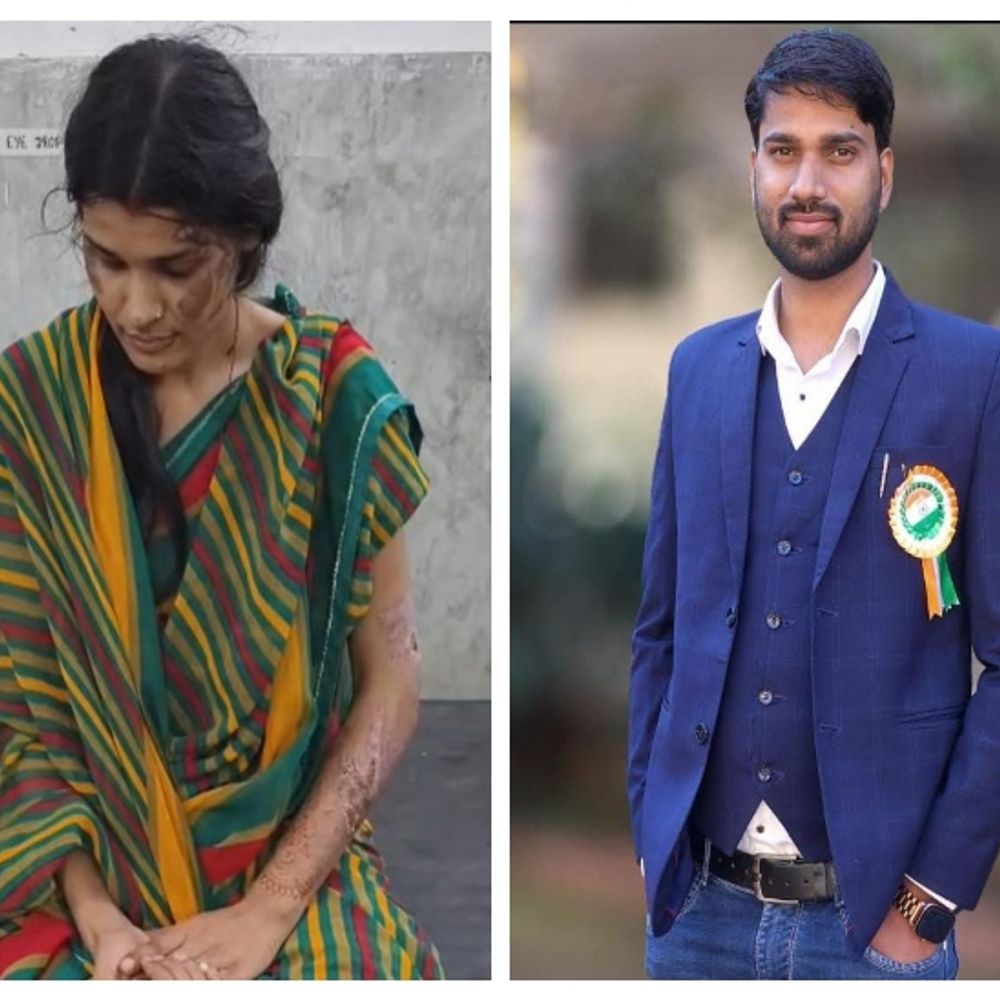 मुंह में कपड़ा ठूंसकर गर्म-पानी में चेहरा जलाने का आरोप:पत्नी बोली- पति का दूसरी महिला से अवैध संबंध, सास-ससुर ने बंधक बनाया